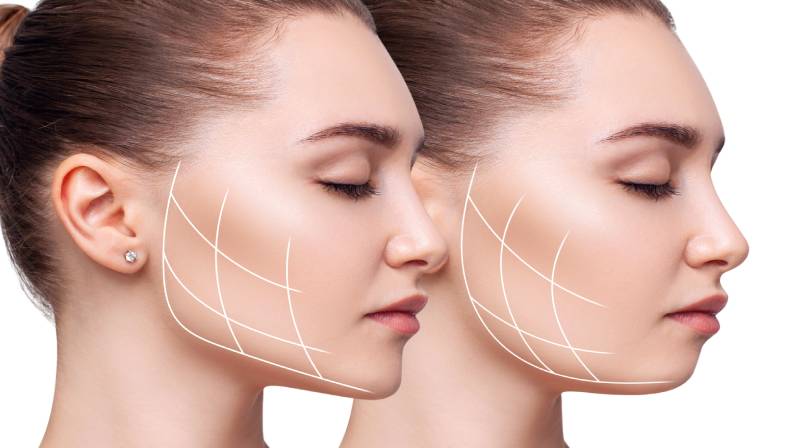 Jawline & Chin
